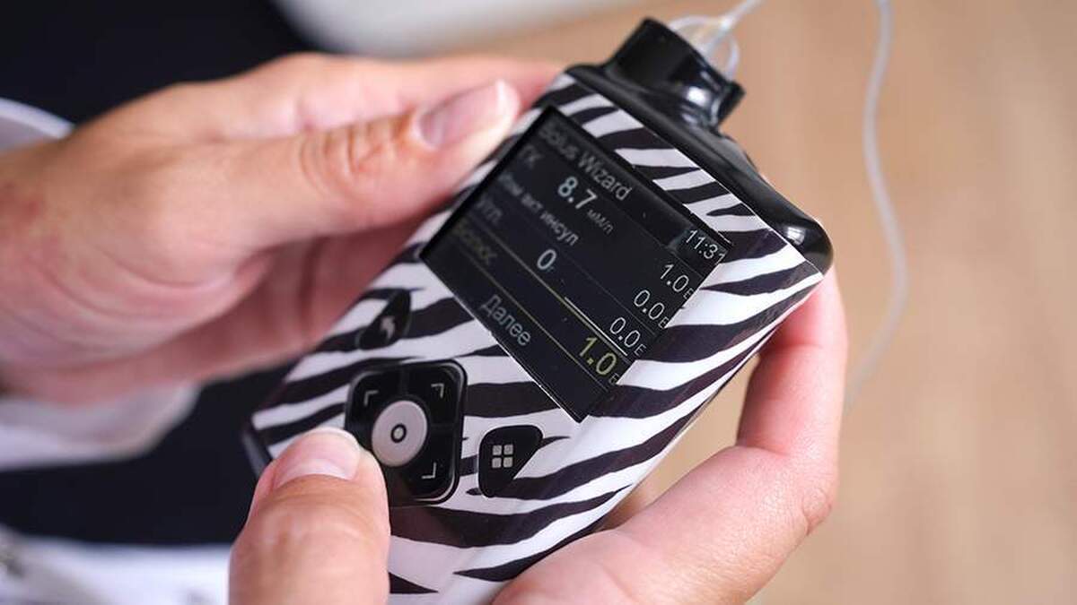 پزشکان علائم دیابت را در کودک ذکر کردند.