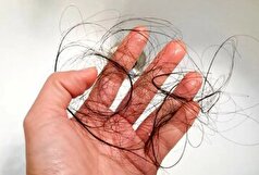 برای جلوگیری از ریزش مو، از این خوراکی‌های در دسترس کمک بگیرید