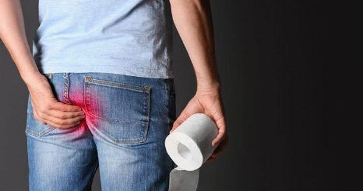 آشنایی با انواع، علت و علائم فیستول مقعدی