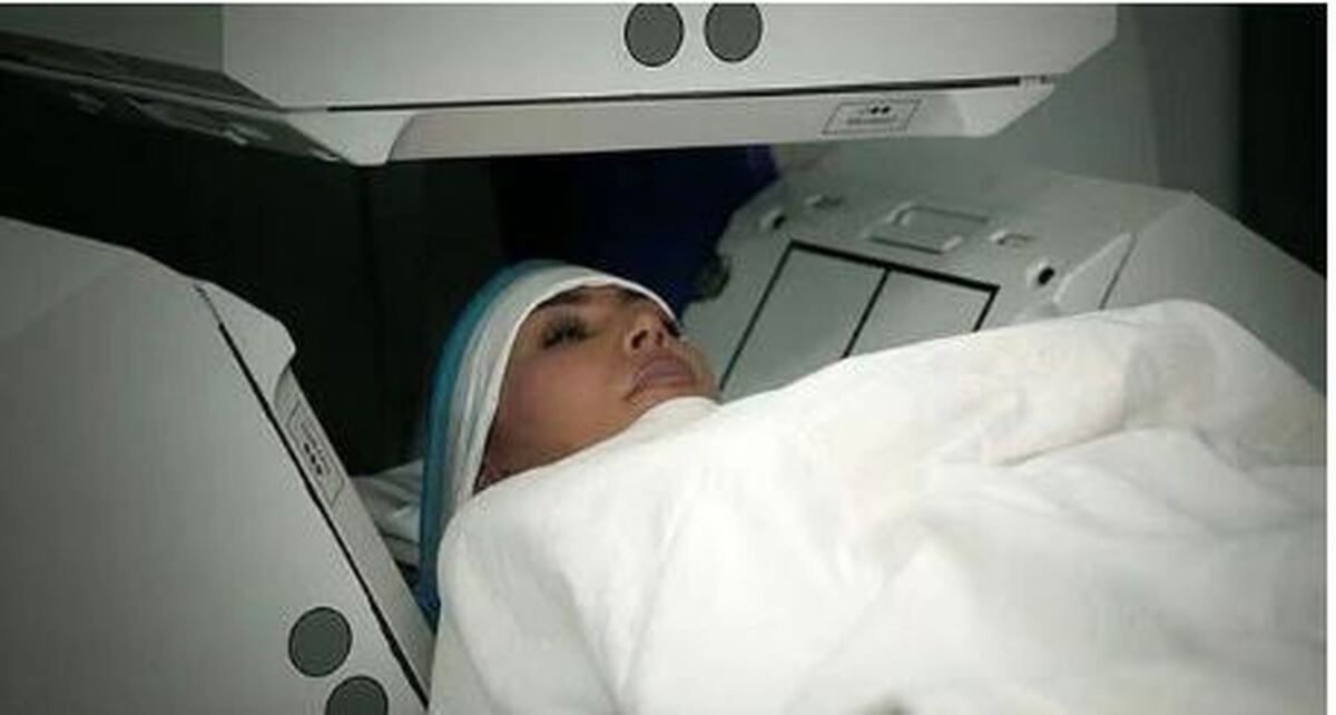 درباره بیماری مغزی کیم کارداشیان چه میدانیم؟