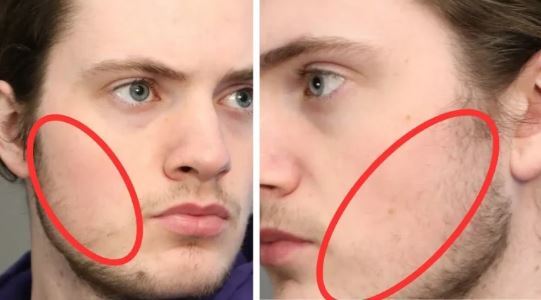 توصیه‌های علمی و کلیدی برای مردانی که قادر به درآوردن ریش نیستند!