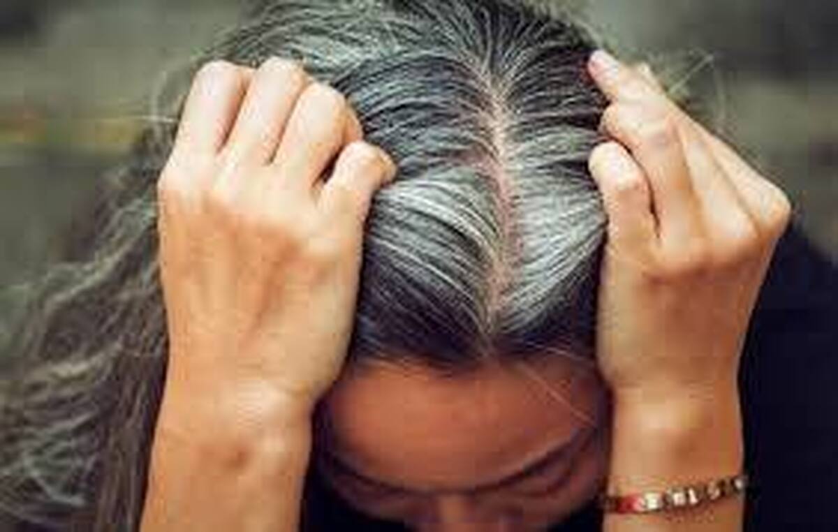 سفید شدن مو در نتیجه پاسخ سلول‌های بنیادی به استرس محیطی