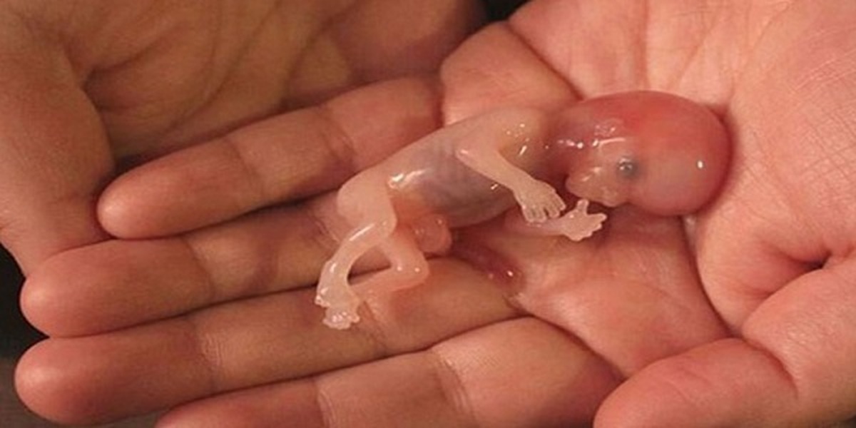 خطر سقط جنین در زنان بالای ۳۵ بیشتر است!