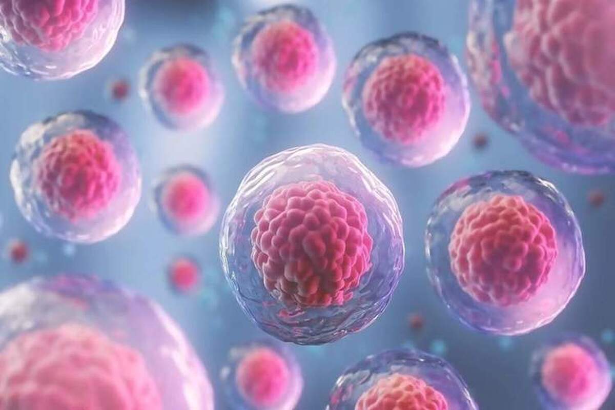 روشی جدید برای جلوگیری از بازگشت سرطان پستان!