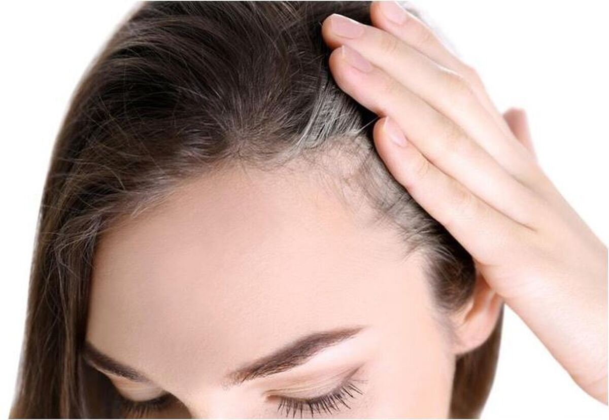 رابطه سفید شدن مو‌ها با سرطان پوست کشف شد