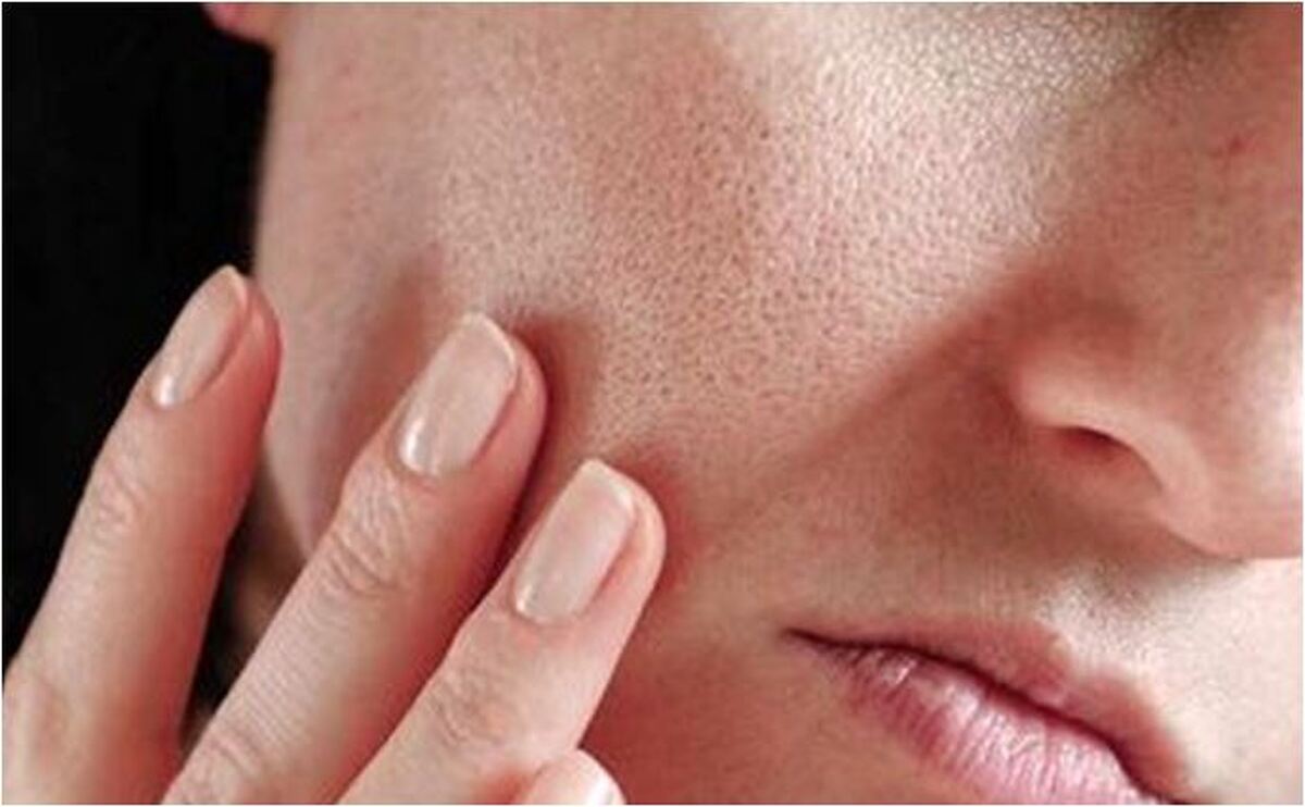 راهی برای شادابی و چاقی صورت بعد از کاهش وزن