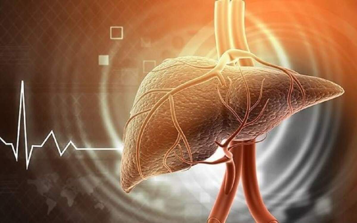 عدم کنترل کبد چرب چه عوارض جدی تری دارد؟