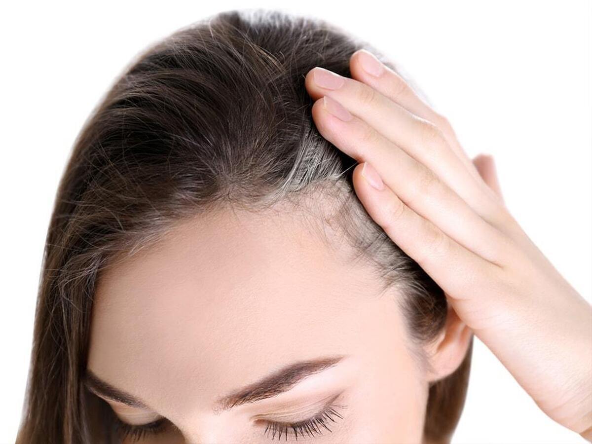 علت جالب سفید شدن مو‌ها پیدا شد