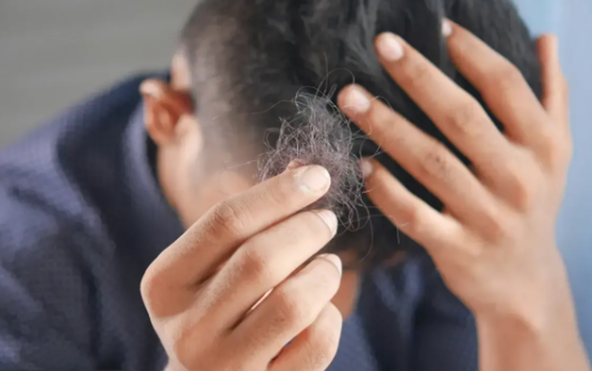 استویا میتواند راهی برای درمان کچلی باشد!