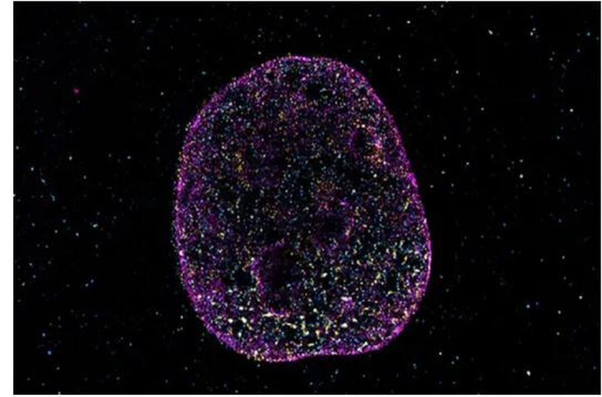 یافتههای دانشمندان در باره زبان دوم بدن و پیری سلولها که منجر به سرطان میشوند