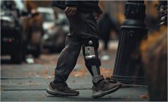 هوش مصنوعی ابزاری جدید برای بهبود کیفیت زندگی افراد با اختلالات حرکتی