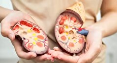 ۳ خوراکی طبیعی که کلیه‌های شما را تصفیه و سالم نگه می‌دارد