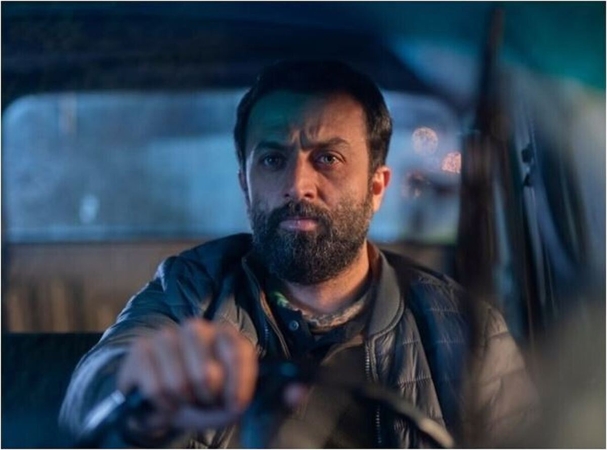 مصطفی زمانی در کودکی افتادگی پلک داشته؟ عکس