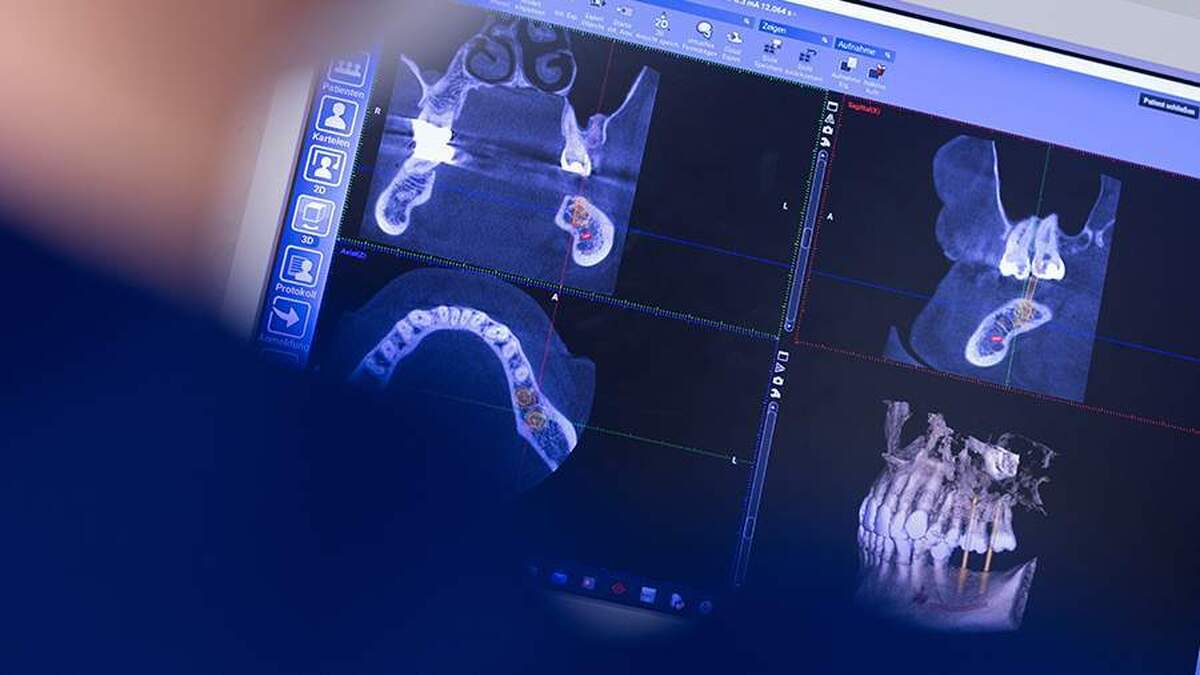 دانشمندان از دست دادن سریع دندان را با افزایش خطر مرگ در افراد مسن مرتبط دانستهاند.