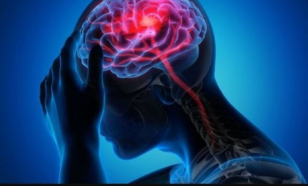 مراجعه سریع به بیمارستان کلید درمان مؤثر سکته مغزی است