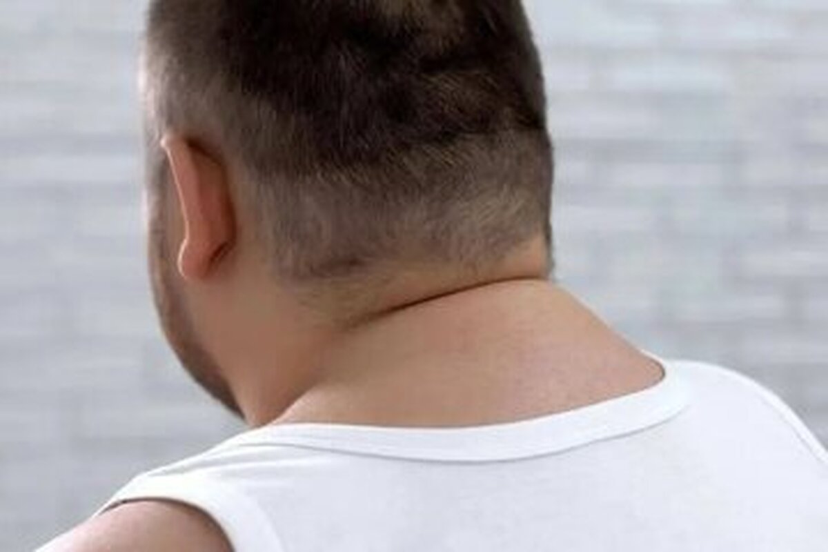 اندازه دور گردن و هشدار‌هایی درباره سلامتی