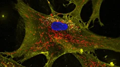 استفاده از فناوری نانوگل‌ها برای تقویت سلول‌های بنیادی!