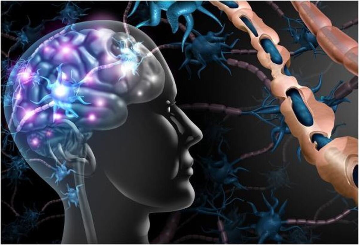 این ویژگی‌های شخصیتی افراد می‌تواند زمینه ساز ابتلا به‌ام اس شود