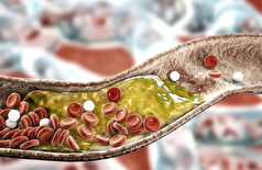 نتایج شگفت‌انگیز در ۳۰ روز: رژیم غذایی که کلسترول را به طور مؤثر مانند دارو کاهش می‌دهد