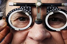 شایع‌ترین بیماری‌های بینایی| علت اصلی آب مروارید