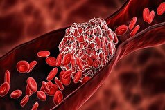 چربی خون بالا چه تاثیری بر رگ‌ها دارد؟