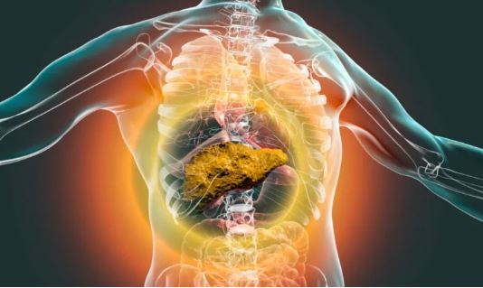 سیروز کبدی؛ بیماری که نشان دهنده فرسایش بزرگ‌ترین غده بدن انسان است