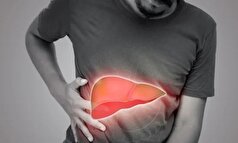 سیروز کبدی؛ بیماری که نشان دهنده فرسایش بزرگ‌ترین غده بدن انسان است