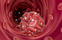 عادات روزانه‌ای که خطر لخته شدن خون را افزایش می‌دهند