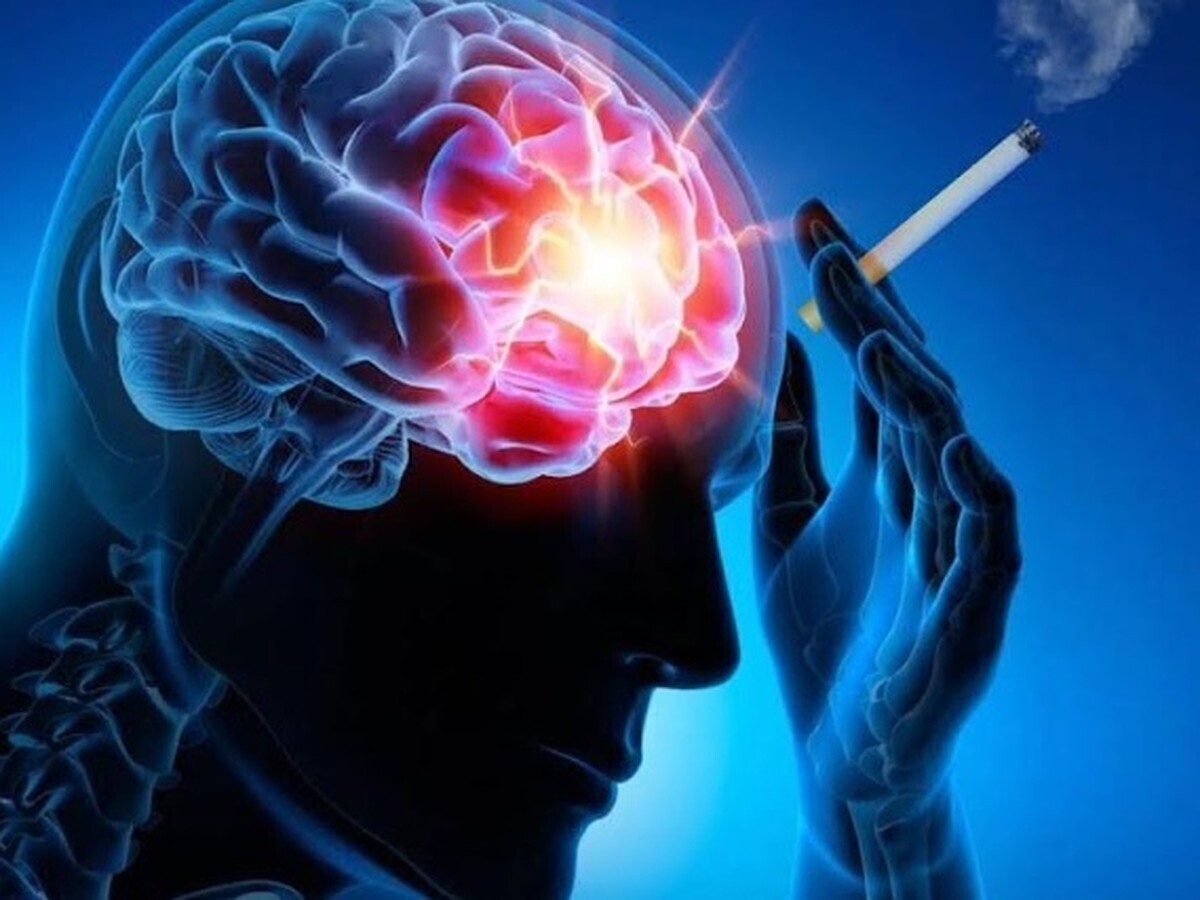 سیگار کشیدن حجم مغز را کاهش می‌دهد و به زوال عقل کمک می‌کند