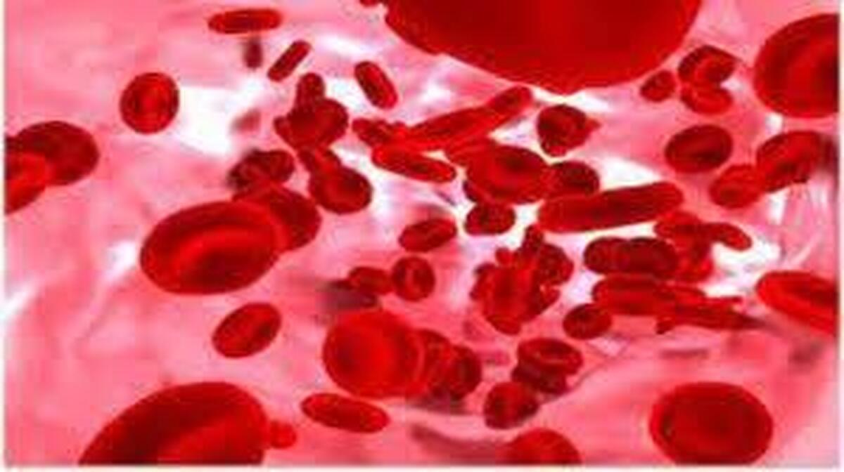 نشانه‌های ابتلا به تالاسمی را بشناسید!