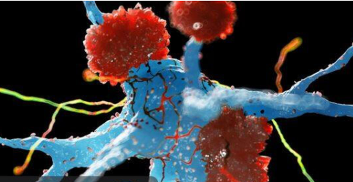 کشف رفتار زیرگونه‌ای از سلول‌های ایمنی مغز در برابر آلزایمر!