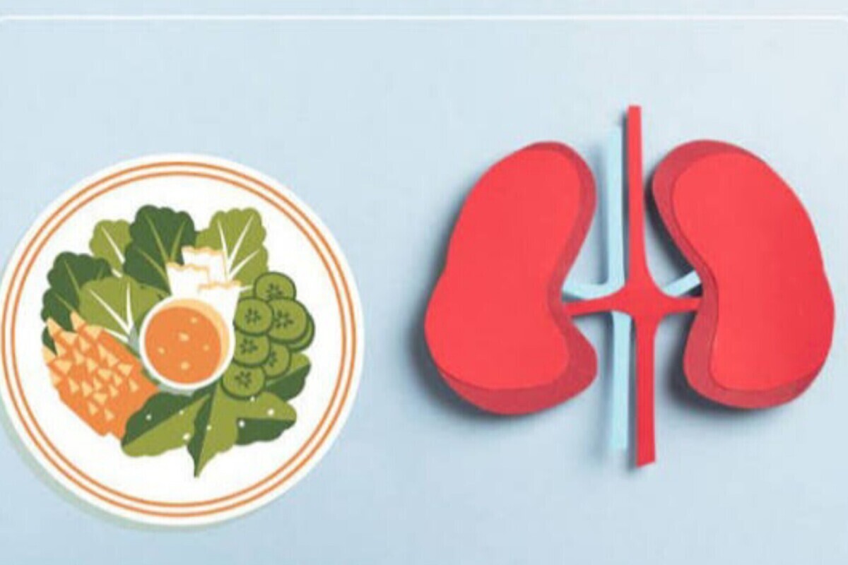 برای پیش‌گیری از سنگ کلیه به رعایت این نکات نیاز دارید!