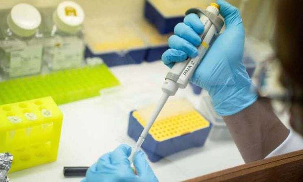 مطالعه: عفونت HIV اغلب در اروپا دیر تشخیص داده می‌شود