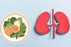 برای پیش‌گیری از سنگ کلیه به رعایت این نکات نیاز دارید!