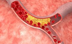 چای سبز به غیر از افزایش سوخت و ساز بدن چه فوایدی دارد؟