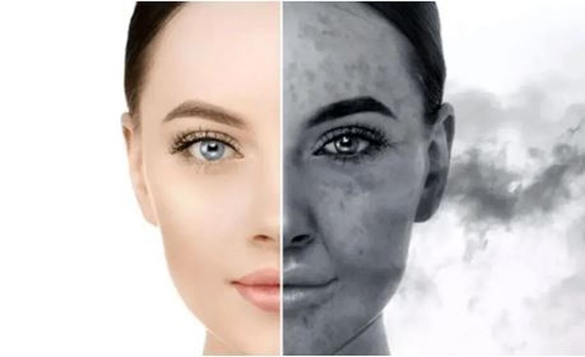 چگونه در مقابل خطرات آلودگی هوا برای پوست مقابله کنیم؟