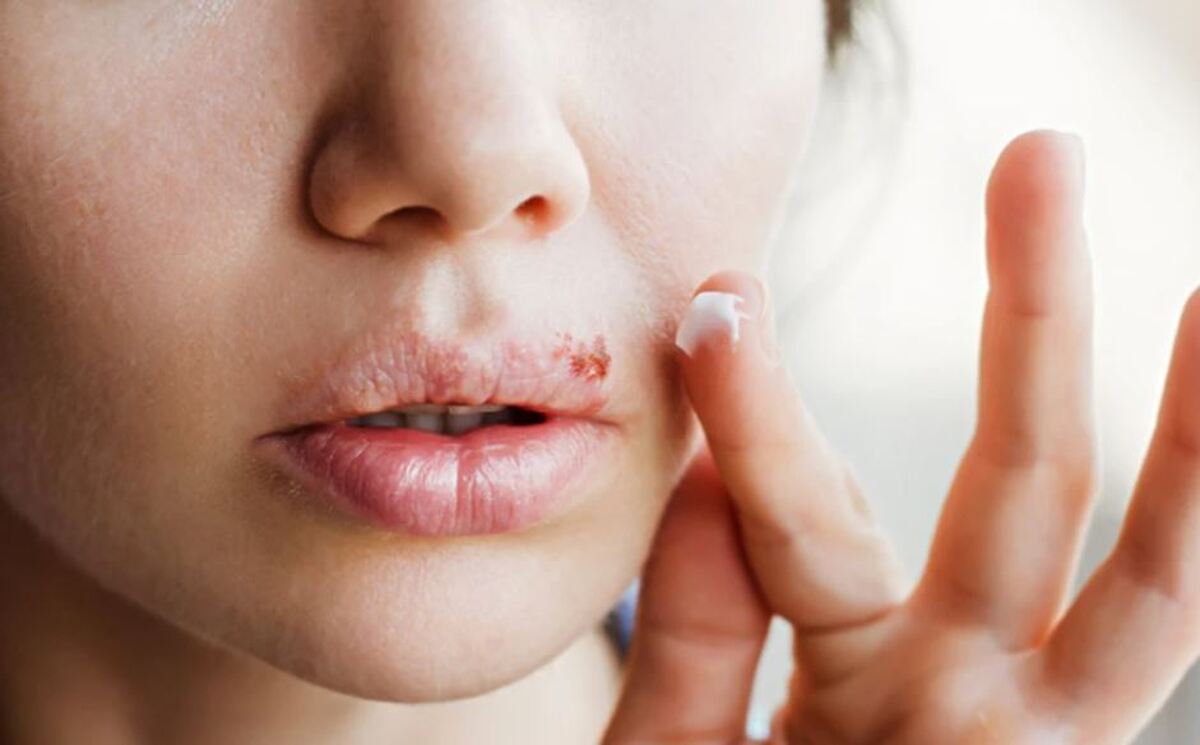 دانشمندان کشف کرده‌اند که سوزاک می‌تواند از طریق بوسیدن منتقل شود.