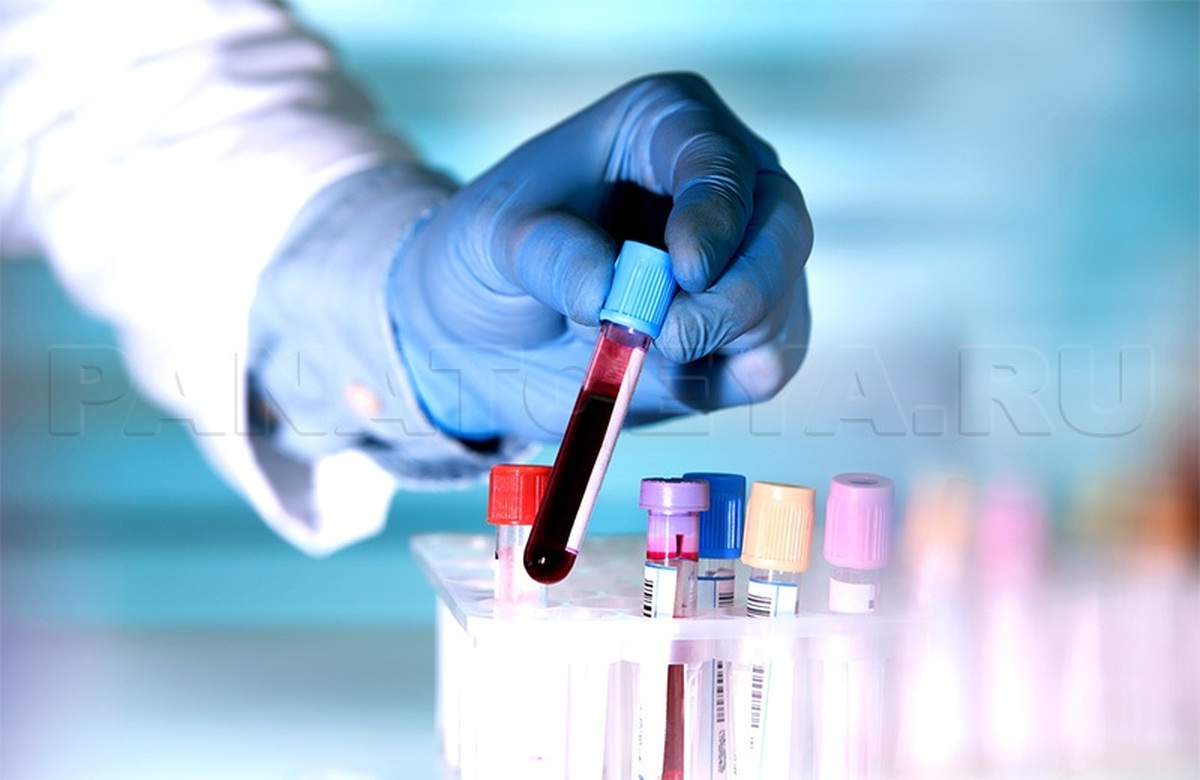 آزمایش مولکول قند خون می‌تواند به تشخیص زودهنگام بیماری آلزایمر کمک کند