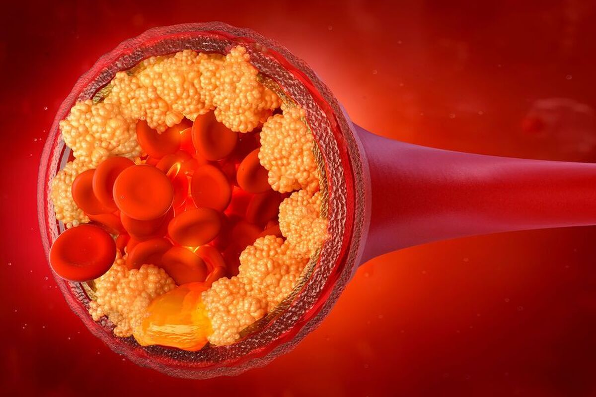 کاهش سطح کلسترول 