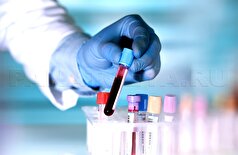 آزمایش مولکول قند خون می‌تواند به تشخیص زودهنگام بیماری آلزایمر کمک کند