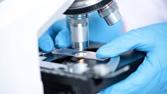 تزریق پپتیدی که آنزیم را هدف قرار می‌دهد ممکن است بیماری آلزایمر را معکوس کند