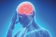 پزشک در مورد سکته مغزی غیرمنتظره هشدار می‌دهد
