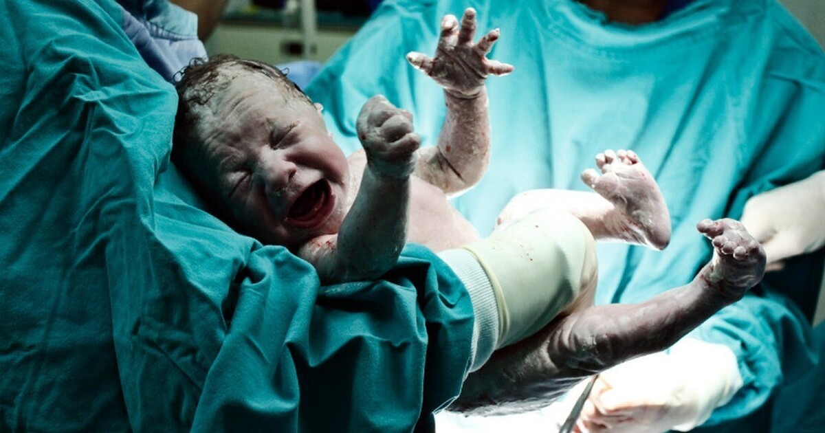 ۳۰ درصد از زنان پس از سزارین به بیماری جدیدی مبتلا می‌شوند