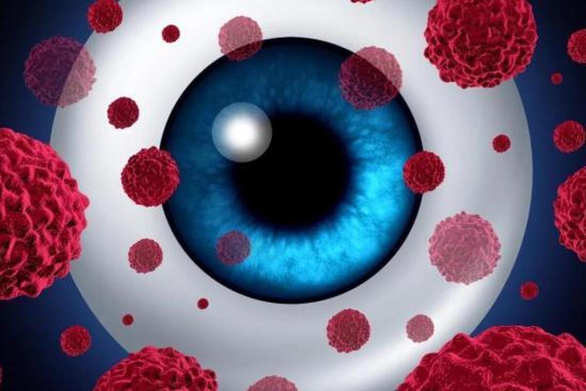 سه رنگ چشم ممکن است از عوامل افزایش خطر ابتلا به سرطان باشند