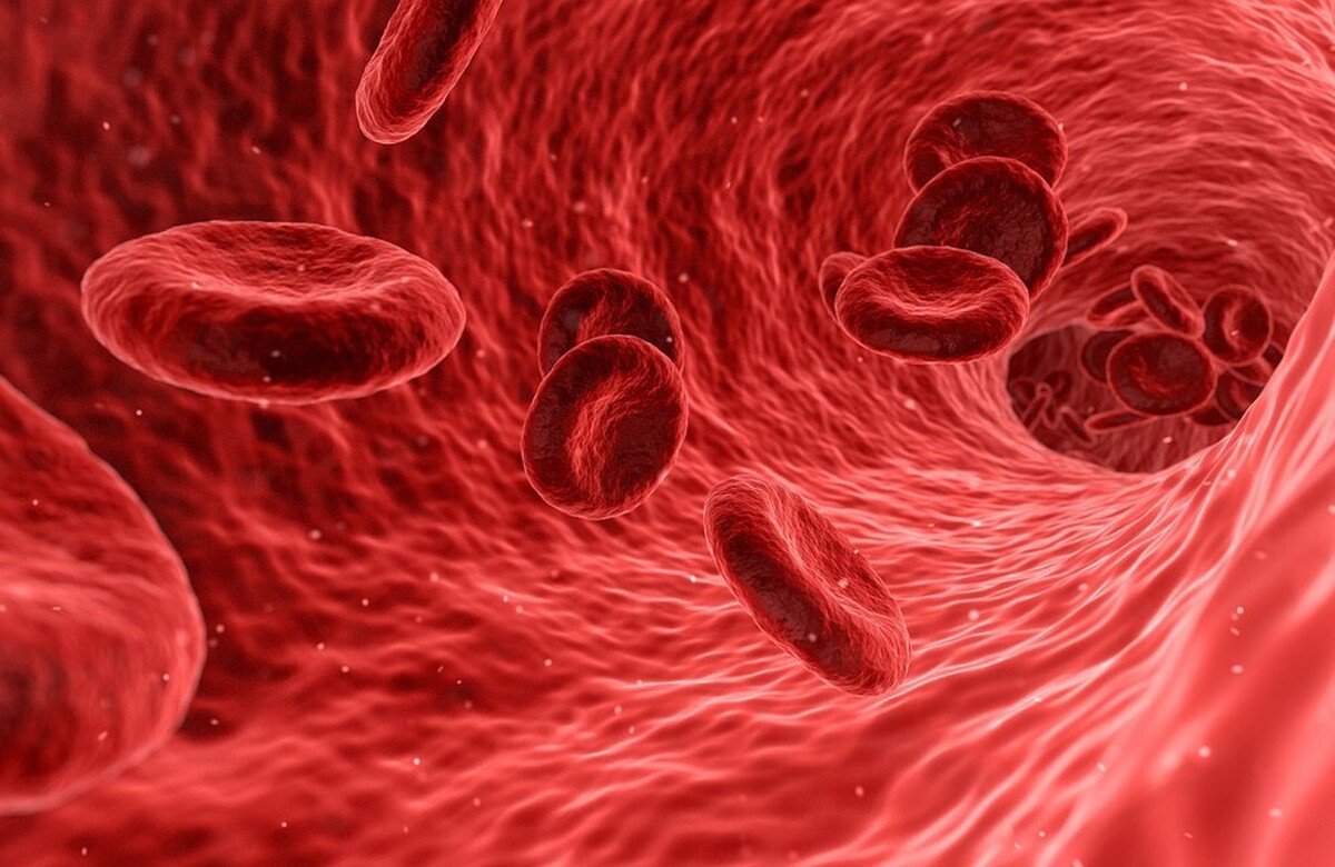 غذا‌های چرب کلید اصلی نیستند: یک پزشک توضیح داد که چه چیزی منجر به غلیظ شدن خون و ترومبوز می‌شود.