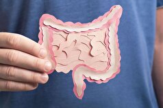 روشی برای تشخیص بیماری‌های روده بدون نیاز به کولونوسکوپی کشف شد.