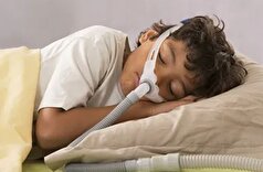 آپنه خواب در دوران کودکی می‌تواند بر عملکرد مغز کودک تأثیر منفی بگذارد.