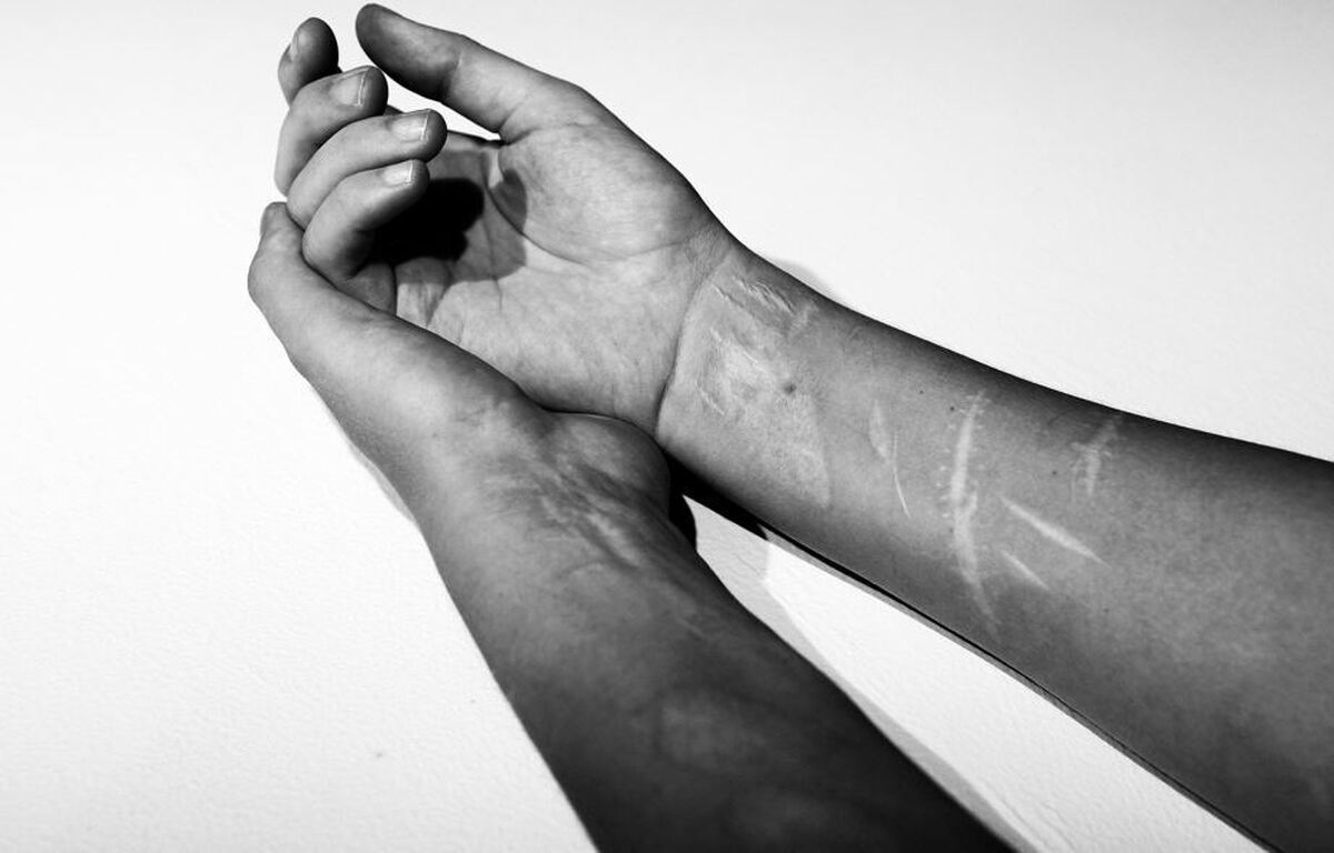 چگونه ملاتونین می‌تواند نوجوانان را از خودآزاری محافظت کند؟