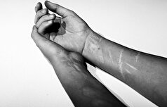 چگونه ملاتونین می‌تواند نوجوانان را از خودآزاری محافظت کند؟