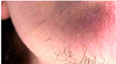 راه رهایی از مو‌های زائد بدون اپیلاسیون و لیزر